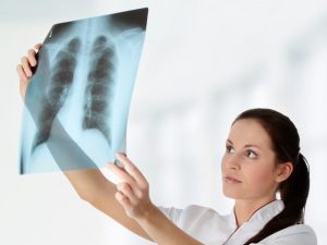 Подробнее о статье 24 марта – Всемирный день борьбы с туберкулезом