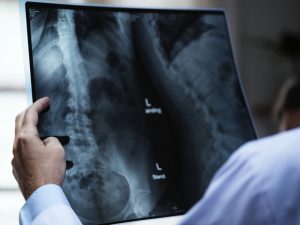 Нейросеть проанализирует КТ-снимки легких в Мариинской больнице