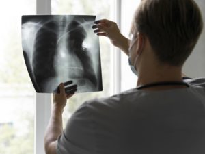 Подробнее о статье Рак лёгкого — одно из самых распространённых и агрессивных онкологических заболеваний